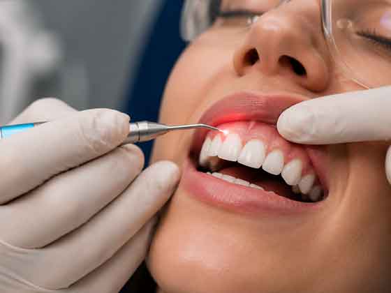 Laser gum lift procedure for gummy smile treatment in Antalya